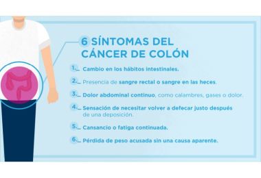 Los seis sntomas que nos alertan de la posibilidad de padecer un cncer de colon