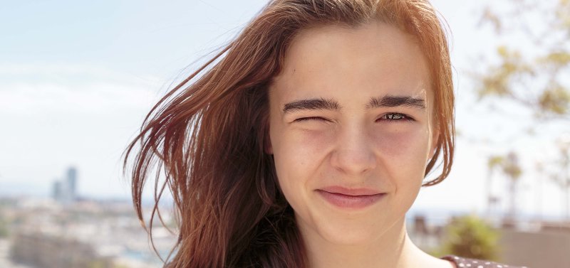 Ptosis palpebral o p�rpado ca�do