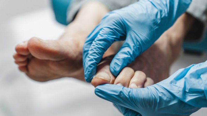 Dedos en garra, mazo y martillo